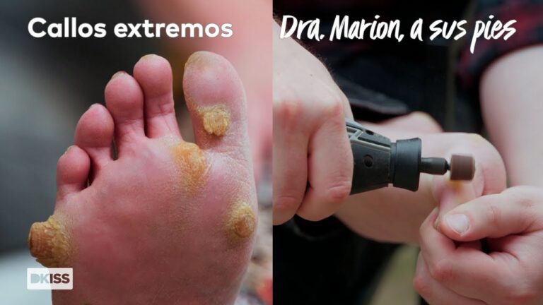 C&oacute;mo actuar ante una emergencia m&eacute;dica en Call&uacute;s